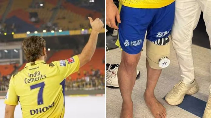 DHONI-LEG
